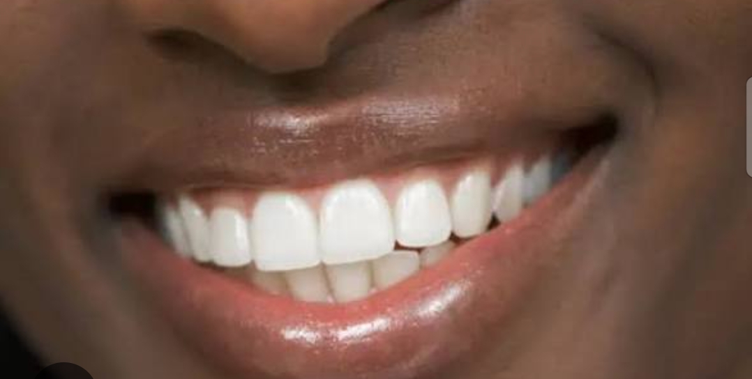 Santé : Une mauvaise hygiène bucco-dentaire peut mettre votre cœur en danger